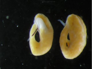 didymo